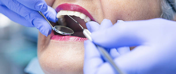 Best Broken or Chipped Tooth Repair in Narrows, VA