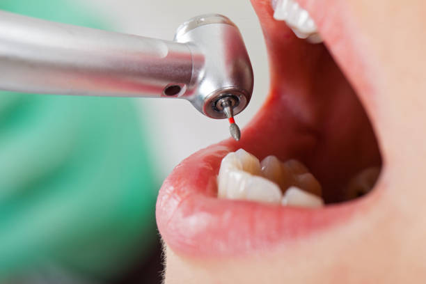 Best Urgent Dental Care for Toothaches in Narrows, VA
